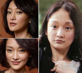 明星长痘痘照片,痘痘无惧镜头，真实肌肤状态引关注