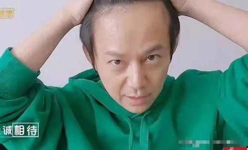 头发稀少的男明星,盘点那些头发稀少的男明星风采